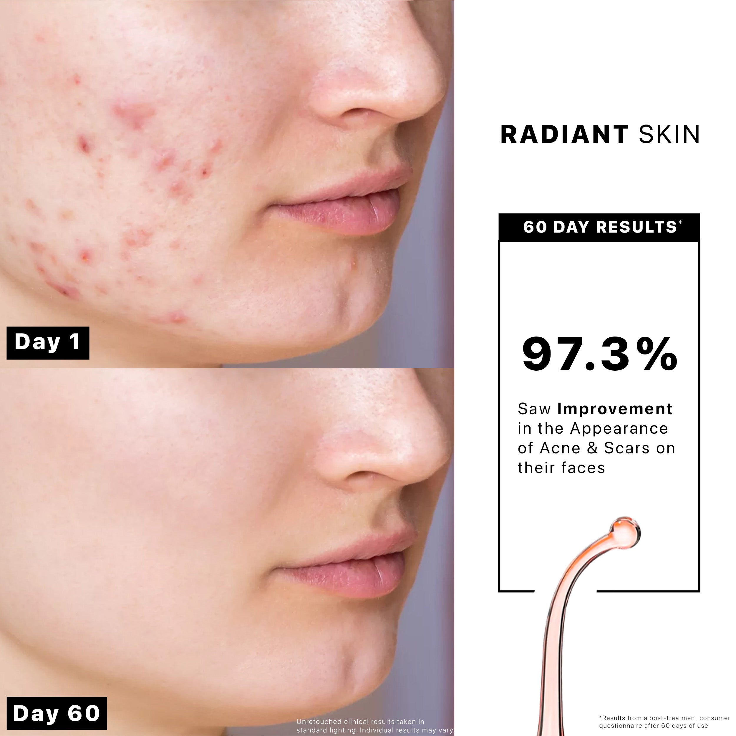 Radiant Skin Pro™